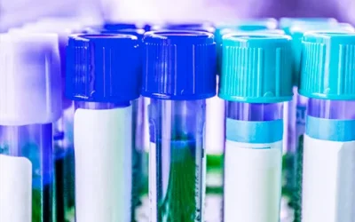 CIERRE POR VACACIONES DE NAVIDAD – SALA DE EXTRACCIONES JOSÉ Mª PEREDA